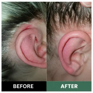 🔥Official U.S. Store  100K+ SOLD 🔥 Dobshow® Avocado & Orange Nourishing Anti-Dandruff Scalp Scrub — A New Steroid-Free Way to Heal an Itchy, Flaky Scalp!✨✨