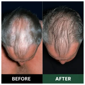 🔥Official U.S. Store 100K+ SOLD 🔥 Dobshow® Avocado & Orange Nourishing Anti-Dandruff Scalp Scrub — A New Steroid-Free Way to Heal an Itchy, Flaky Scalp!✨✨