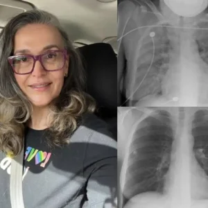 US👨‍⚕️✅ Dobshow® Botanical Mullein Lung Cleanse Diffuser 🌿(🫁Cough, Pharyngitis, shortness of breath, sputum, stuffy nose, bronchitis, bronchitis, allergy symptoms, lung discomfort💝)