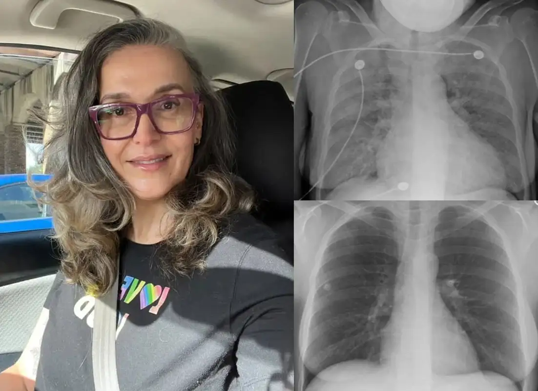 US👨⚕️✅ Dobshow® Botanical Mullein Lung Cleanse Diffuser 🌿(🫁Cough, Pharyngitis, shortness of breath, sputum, stuffy nose, bronchitis, bronchitis, allergy symptoms, lung discomfort💝)