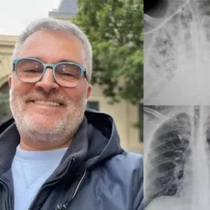 US👨⚕️✅ Dobshow® Botanical Mullein Lung Cleanse Diffuser 🌿(🫁Cough, Pharyngitis, shortness of breath, sputum, stuffy nose, bronchitis, bronchitis, allergy symptoms, lung discomfort💝)