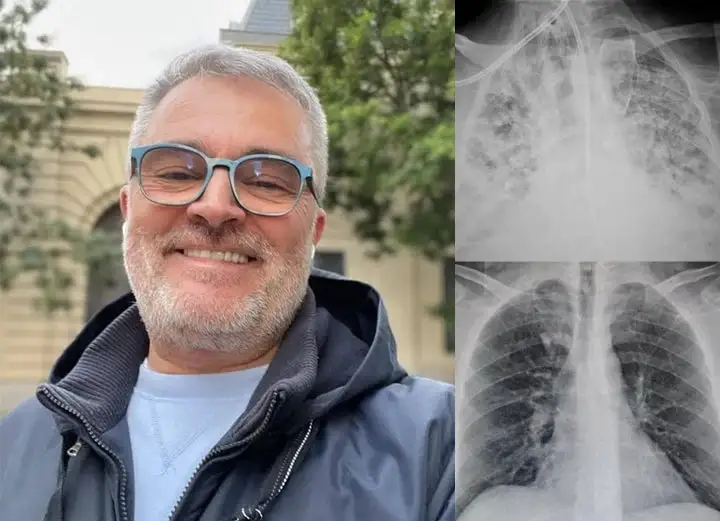 US👨⚕️✅ Dobshow® Botanical Mullein Lung Cleanse Diffuser 🌿(🫁Cough, Pharyngitis, shortness of breath, sputum, stuffy nose, bronchitis, bronchitis, allergy symptoms, lung discomfort💝)