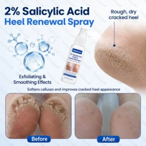 ⭐ Advanced Heel Repair ·Dobshow® 2% Salicylic Acid Callus & Cracked Heel Spray