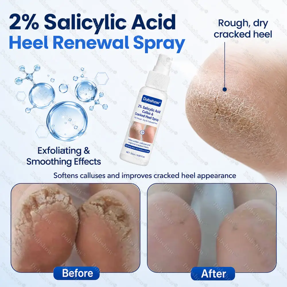 ⭐ Advanced Heel Repair ·Dobshow® 2% Salicylic Acid Callus & Cracked Heel Spray