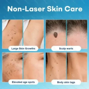 Dobshow® 7 -Day Wart & Blemish Remover