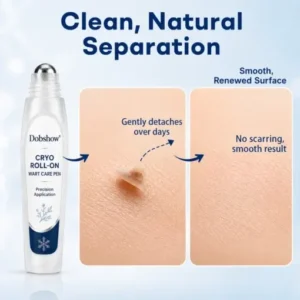 Dobshow® 7 -Day Wart & Blemish Remover