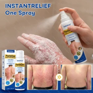 Dobshow® PsoriaClear No-Rub Psoriasis Relief Spray