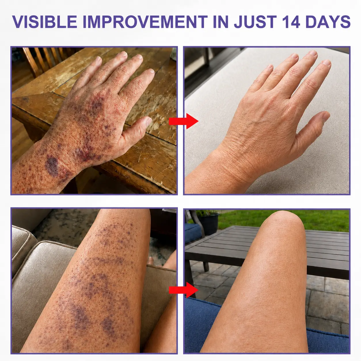 🏆𝐎𝐟𝐟𝐢𝐜𝐢𝐚𝐥 𝐔𝐒 𝐒𝐭𝐨𝐫𝐞🎉100K+ SOLD 🔥 Dobshow® Dark Spot & Bruise Recovery Cream