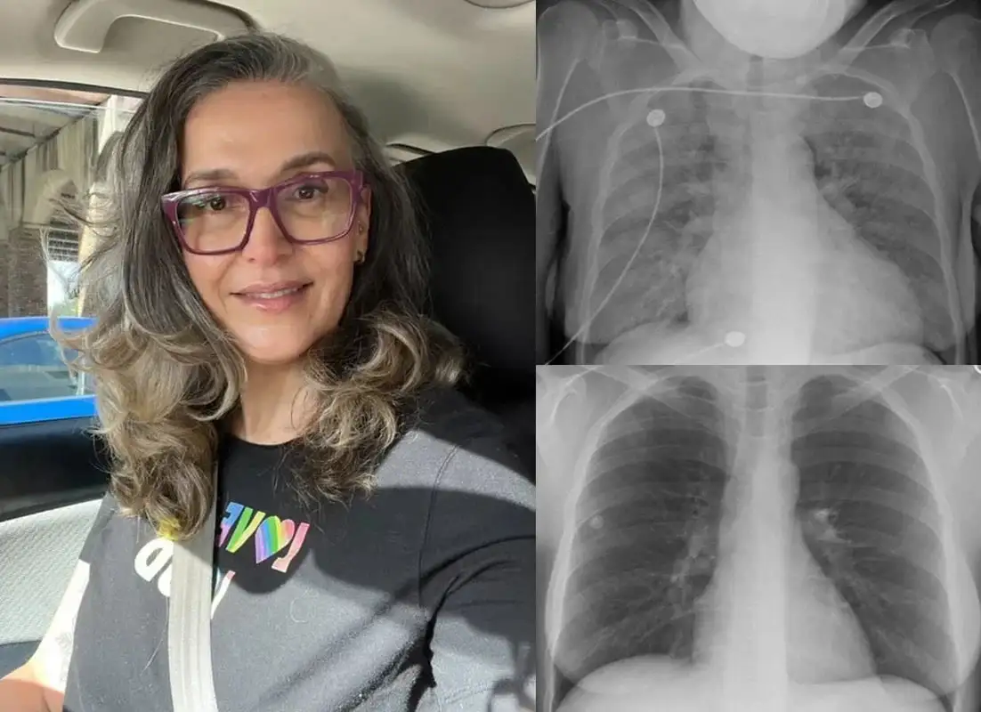 🏆𝐎𝐟𝐟𝐢𝐜𝐢𝐚𝐥 𝐔𝐒 𝐒𝐭𝐨𝐫𝐞🎉Over 100K+ Sold🔥 Dobshow® All-New Upgraded Botanical Mullein Lung Cleanse Diffuser 🌿 — 🫁Restore Your Lung Health