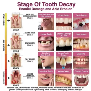 Dobshow® 🦷 DenPerm Cavity-Repair Advanced Enamel Filling Gel